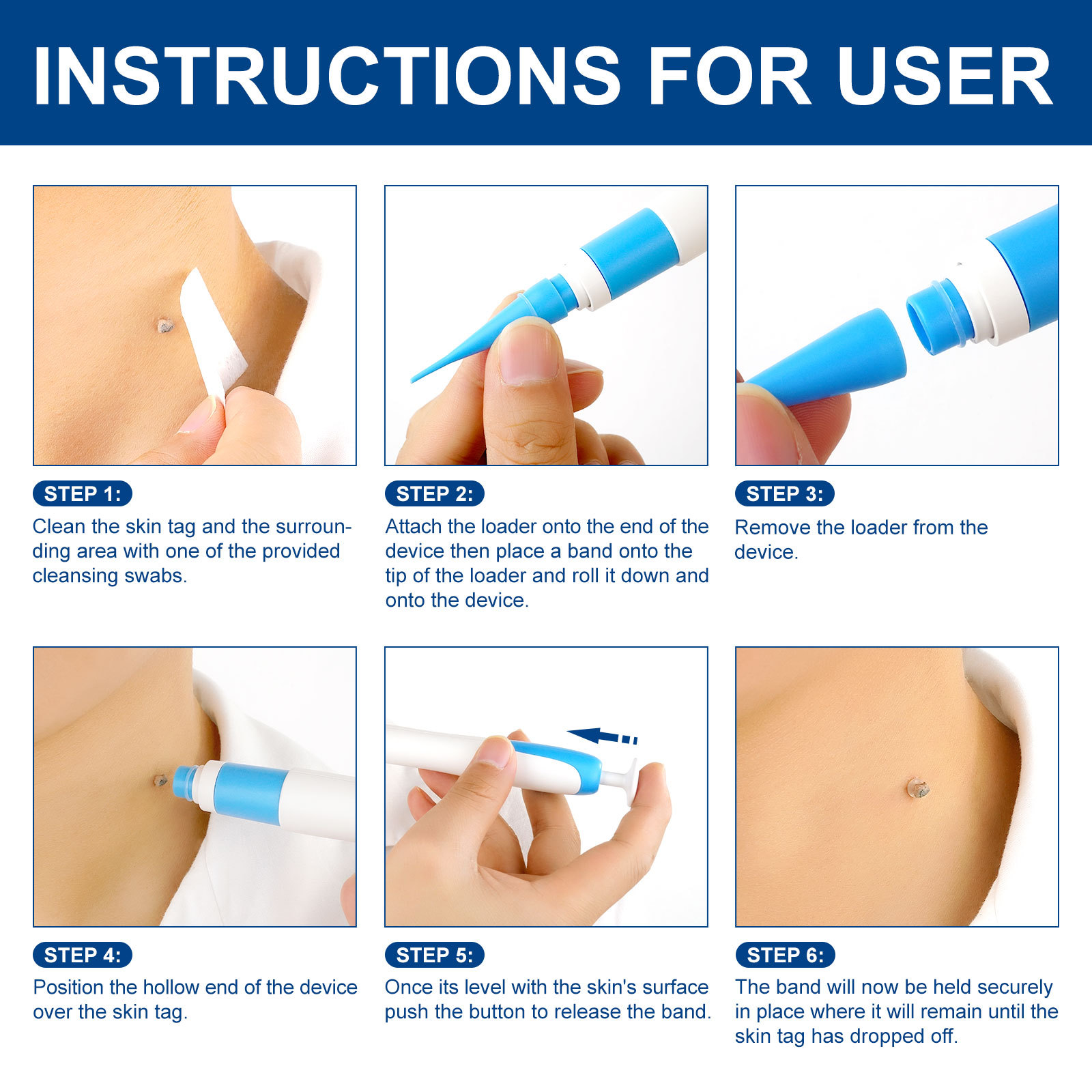 2-IN-1 Auto Skin Tag Removal K - đánh giá và giá Home Improvement And Tools